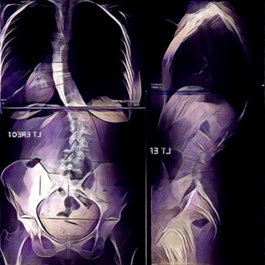 Ballarat Spinal Health Full Spine XRays